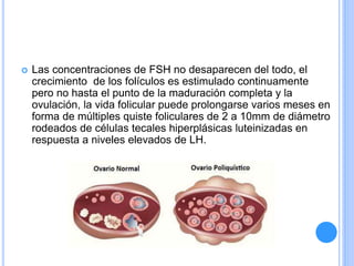  Las concentraciones de FSH no desaparecen del todo, el
crecimiento de los folículos es estimulado continuamente
pero no hasta el punto de la maduración completa y la
ovulación, la vida folicular puede prolongarse varios meses en
forma de múltiples quiste foliculares de 2 a 10mm de diámetro
rodeados de células tecales hiperplásicas luteinizadas en
respuesta a niveles elevados de LH.
 