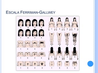 ESCALA FERRIMAN-GALLWEY
 
