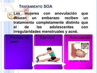 TRATAMIENTO SOA
Las mujeres con anovulación que
desean un embarazo reciben un
tratamiento completamente distinto que
el de las adolescentes con
irregularidades menstruales y acné.
Pérdida de
peso
Ejercicio Anovulación
8 por año
 
