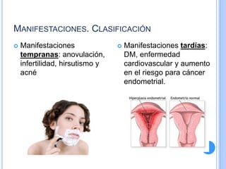 MANIFESTACIONES. CLASIFICACIÓN
 Manifestaciones
tempranas: anovulación,
infertilidad, hirsutismo y
acné
 Manifestaciones tardías:
DM, enfermedad
cardiovascular y aumento
en el riesgo para cáncer
endometrial.
 