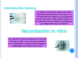 se utiliza una pequeña aguja para crear
pequeñas perforaciones en el ovario. La
corriente eléctrica destruye una pequeña
porción del ovario. Esto puede resultar en
la reducción de los niveles de andrógenos
y la restauración de la ovulación.
se cosechan óvulos inmaduros al inicio del
ciclo de la mujer. Los huevos se maduran
en un laboratorio y luego son fecundados e
implantados en el útero de la mujer.
 