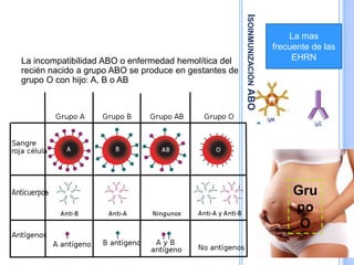 ISOINMUNIZACIÓNABO
La incompatibilidad ABO o enfermedad hemolítica del
recién nacido a grupo ABO se produce en gestantes de
grupo O con hijo: A, B o AB
La mas
frecuente de las
EHRN
Gru
po
O
 