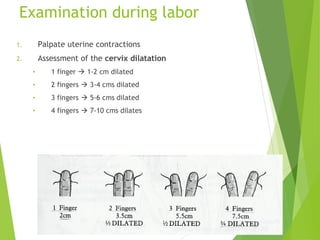 Examination during labor 
1. Palpate uterine contractions 
2. Assessment of the cervix dilatation 
• 1 finger  1-2 cm dilated 
• 2 fingers  3-4 cms dilated 
• 3 fingers  5-6 cms dilated 
• 4 fingers  7-10 cms dilates 
 