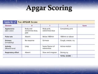 Apgar Scoring
 