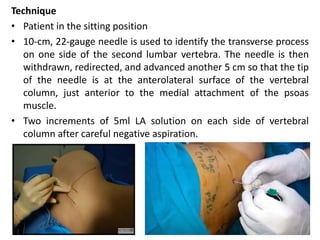 Technique
• Patient in the sitting position
• 10-cm, 22-gauge needle is used to identify the transverse process
on one side of the second lumbar vertebra. The needle is then
withdrawn, redirected, and advanced another 5 cm so that the tip
of the needle is at the anterolateral surface of the vertebral
column, just anterior to the medial attachment of the psoas
muscle.
• Two increments of 5ml LA solution on each side of vertebral
column after careful negative aspiration.
 
