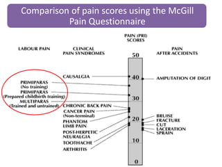 Comparison of pain scores using the McGill
Pain Questionnaire
 