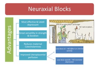 Neuraxial BlocksAdvantages
Most effective & Least
depressant
Great versatility in strength
& Duration
Reduces maternal
Catecholamines
Improved Uteroplacental
perfusion
Low dose LA – NO Effect on Uterine
activity
Low dose opioids – NO neonatal
depression
 