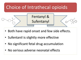 Choice of Intrathecal opioids
• Both have rapid onset and few side effects.
• Sufentanil is slightly more effective
• No significant fetal drug accumulation
• No serious adverse neonatal effects
Fentanyl &
Sufentanyl
 