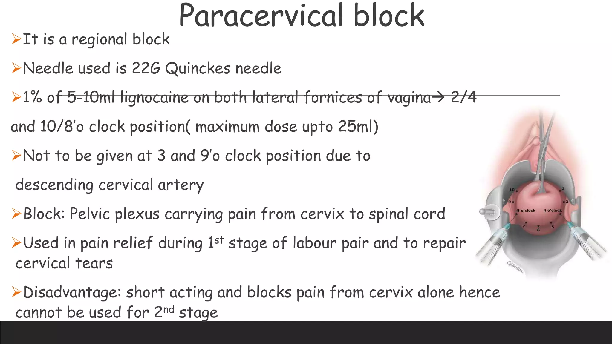 Curated visual reference: Obstetrics And Anesthesia Ppt Photo Inspiration