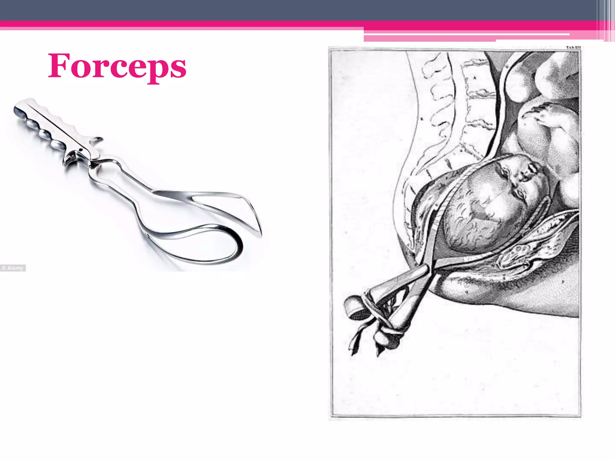 Forceps
 