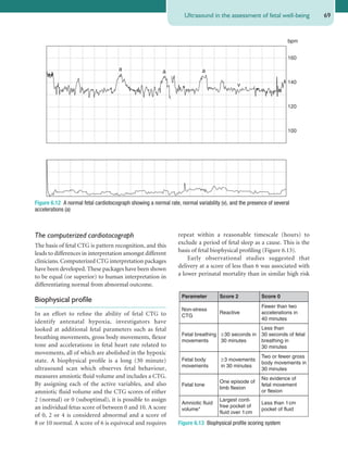 Obstetrics Notes and Review | PDF