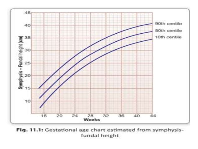 obstetrics history taking examination fundal height measurement chart