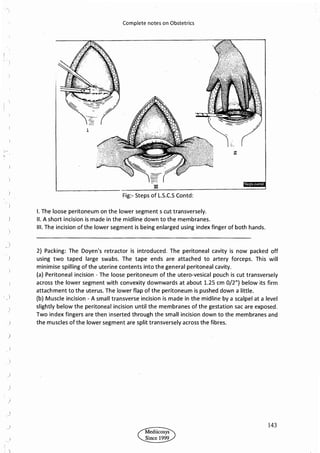 Obstetrics High Yield notes - For revision. .pdf