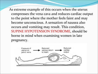 As extreme example of this occurs when the uterus compresses the vena cava and reduces cardiac output to the point where the mother feels faint and may become unconscious. A sensation of nausea also occurs and vomiting may result. This condition,  SUPINE HYPOTENSION SYNDROME , should be borne in mind when examining women in late pregnancy. 