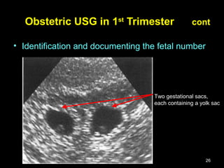 Gs Measure Obstetric ultrasound | PPT