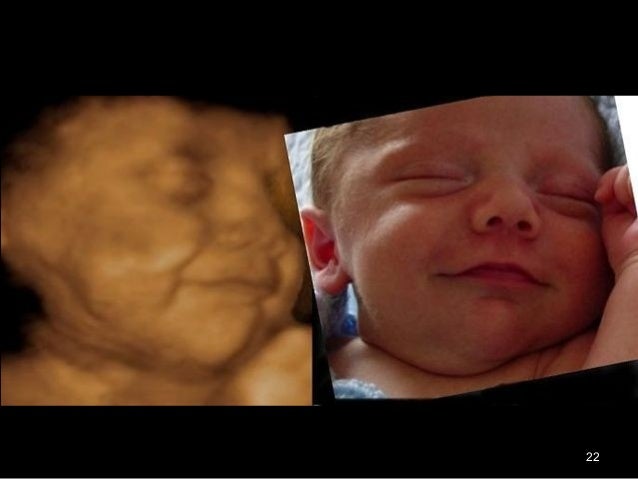 photo of 17 week old fetus
