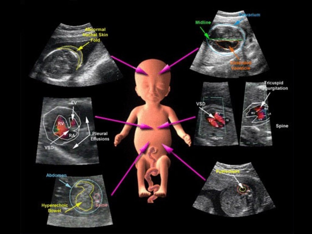 presentation in ultrasound