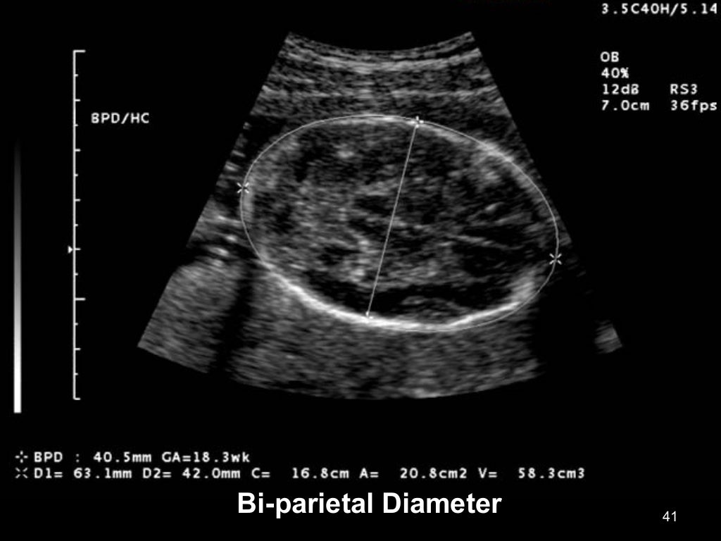 Obstetric ultrasound