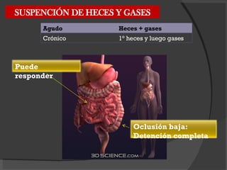 SUSPENCIÓN DE HECES Y GASES Agudo Heces + gases Crónico 1° heces y luego gases Puede responder Oclusión baja: Detención completa 