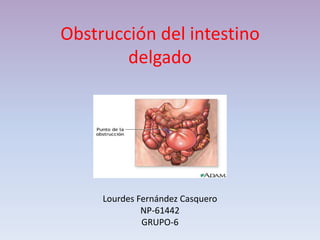 Obstrucción del intestino
        delgado




     Lourdes Fernández Casquero
              NP-61442
              GRUPO-6
 