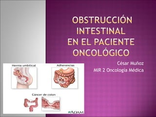 César Muñoz MIR 2 Oncología Médica 