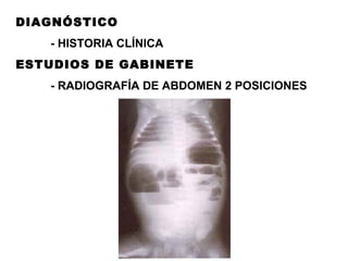 DIAGNÓSTICO - HISTORIA CLÍNICA ESTUDIOS DE GABINETE - RADIOGRAFÍA DE ABDOMEN 2 POSICIONES