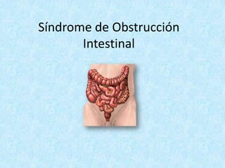 Síndrome de Obstrucción
Intestinal
 