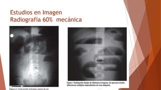 Estudios en Imagen
Radiografía 60% mecánica
 