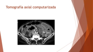 Tomografía axial computarizada
 