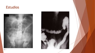 Estudios
 