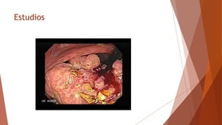 Estudios
 