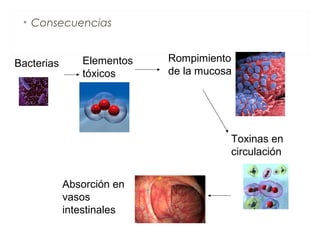 • Consecuencias
Bacterias Elementos
tóxicos
Rompimiento
de la mucosa
Toxinas en
circulación
Absorción en
vasos
intestinales
 