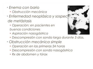 • Enema con bario
• Obstrucción mecánica
• Enfermedad neoplásica y sospecha
de metástasis
• Operación: en pacientes en
buenas condiciones
• Aspiración nasogástrica
• Descompresión con sonda larga durante 3 días.
• Obstrucción mecánica simple
• Operación en las primeras 24 horas
• Descompresión con sonda nasogástrica
• Rx de abdomen y tórax
 