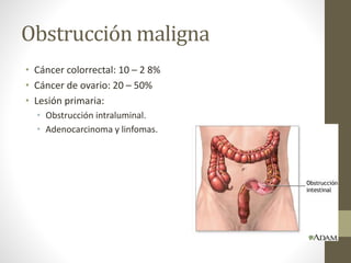 Obstrucción maligna
• Cáncer colorrectal: 10 – 2 8%
• Cáncer de ovario: 20 – 50%
• Lesión primaria:
• Obstrucción intraluminal.
• Adenocarcinoma y linfomas.
 