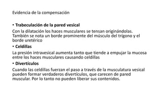 Evidencia de la compensación
• Trabeculación de la pared vesical
Con la dilatación los haces musculares se tensan originándolas.
También se nota un borde prominente del músculo del trígono y el
borde uretérico
• Celdillas
La presión intravesical aumenta tanto que tiende a empujar la mucosa
entre los haces musculares causando celdillas
• Divertículos
Cuando las celdillas fuerzan el paso a través de la musculatura vesical
pueden formar verdaderos divertículos, que carecen de pared
muscular. Por lo tanto no pueden liberar sus contenidos.
 