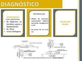 RADIOLOGICO
SERIE ABDOMINAL
• Rx. Abdomen en
decúbito supino y
bipedestación
• Rx. Tórax
• Incluir diafragma
COLON POR
ENEMA
ENTEROCLISIS
• Medio de contraste
hidrosoluble (100ml)
porsonda nasogástrica
o VO.
• Se toman Rx. En 4-24
hrs
 