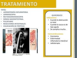 TIPOS:
• LAPAROTOMÍA EXPLORATORIA
• LAPARASCOPIA
• RECTOSIGMOIDOSCOPIA
• SONDA NASOINTESTINAL
• PLICATURAS
• RESECCIONES INTESTINALES
• COLOCACIÓN DE PRÓTESIS
QUIRÚRGICO
• Indicaciones
• Cuando la obstrucción
es total
• Cuando la causa es de
tipo aguda
• Se complica mucho.
Contraindicaciones
• Carcinoma
• Enfermedad
inflamatoria intestinal
• radioterapia
 