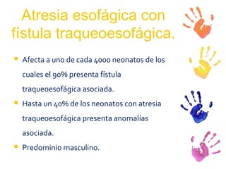 Atresia esofágica con fístula traqueoesofágica. Afecta a uno de cada 4000 neonatos de los cuales el 90% presenta fístula traqueoesofágica asociada. Hasta un 40% de los neonatos con atresia traqueoesofágica presenta anomalías asociada.  Predominio masculino.  