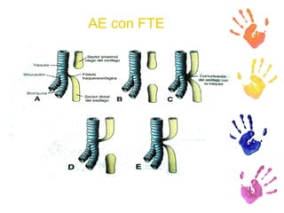 AE con FTE 