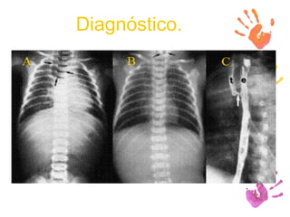 Diagnóstico. 