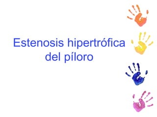 Estenosis hipertrófica del píloro 