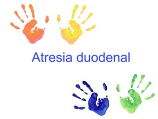 Atresia duodenal 