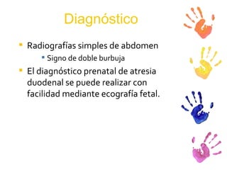 Diagnóstico Radiografías simples de abdomen Signo de doble burbuja El diagnóstico prenatal de atresia duodenal se puede realizar con facilidad mediante ecografía fetal.  