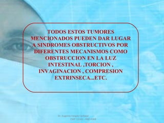 TODOS ESTOS TUMORES
MENCIONADOS PUEDEN DAR LUGAR
A SINDROMES OBSTRUCTIVOS POR
DIFERENTES MECANISMOS COMO
OBSTRUCCION EN LA LUZ
INTESTINAL ,TORCION ,
INVAGINACION , COMPRESION
EXTRINSECA...ETC.
Dr. Eugenio Vargas Carbajal
CMP 11161 - RNE 4368
 