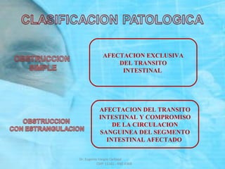 AFECTACION EXCLUSIVA
DEL TRANSITO
INTESTINAL
AFECTACION DEL TRANSITO
INTESTINAL Y COMPROMISO
DE LA CIRCULACION
SANGUINEA DEL SEGMENTO
INTESTINAL AFECTADO
Dr. Eugenio Vargas Carbajal
CMP 11161 - RNE 4368
 
