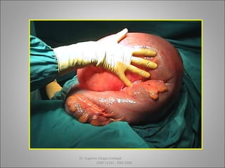 Dr. Eugenio Vargas Carbajal
CMP 11161 - RNE 4368
 