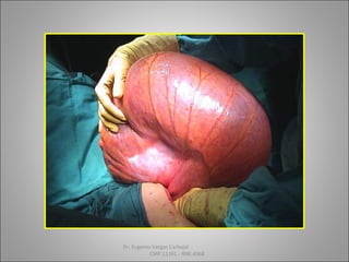 Dr. Eugenio Vargas Carbajal
CMP 11161 - RNE 4368
 