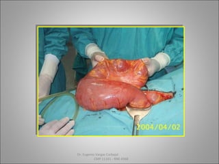 Dr. Eugenio Vargas Carbajal
CMP 11161 - RNE 4368
 