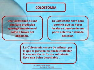Dr. Eugenio Vargas Carbajal
CMP 11161 - RNE 4368
COLOSTOMIA
Una Colostomía es una 
abertura producida 
quirúrgicamente en el 
colon a través del 
abdomen. 
La Colostomía sirve para 
permitir que las heces 
fecales se desvíen de una 
parte enferma o dañada 
del colon 
La Colostomía carece de esfínter, por
lo que la persona no puede controlar
la evacuación de forma voluntaria,
lleva una bolsa desechable .
 
