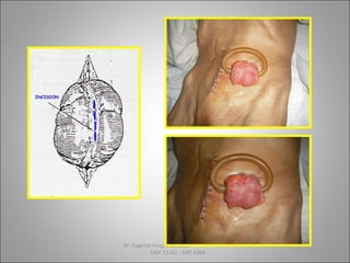 Dr. Eugenio Vargas Carbajal
CMP 11161 - RNE 4368
 